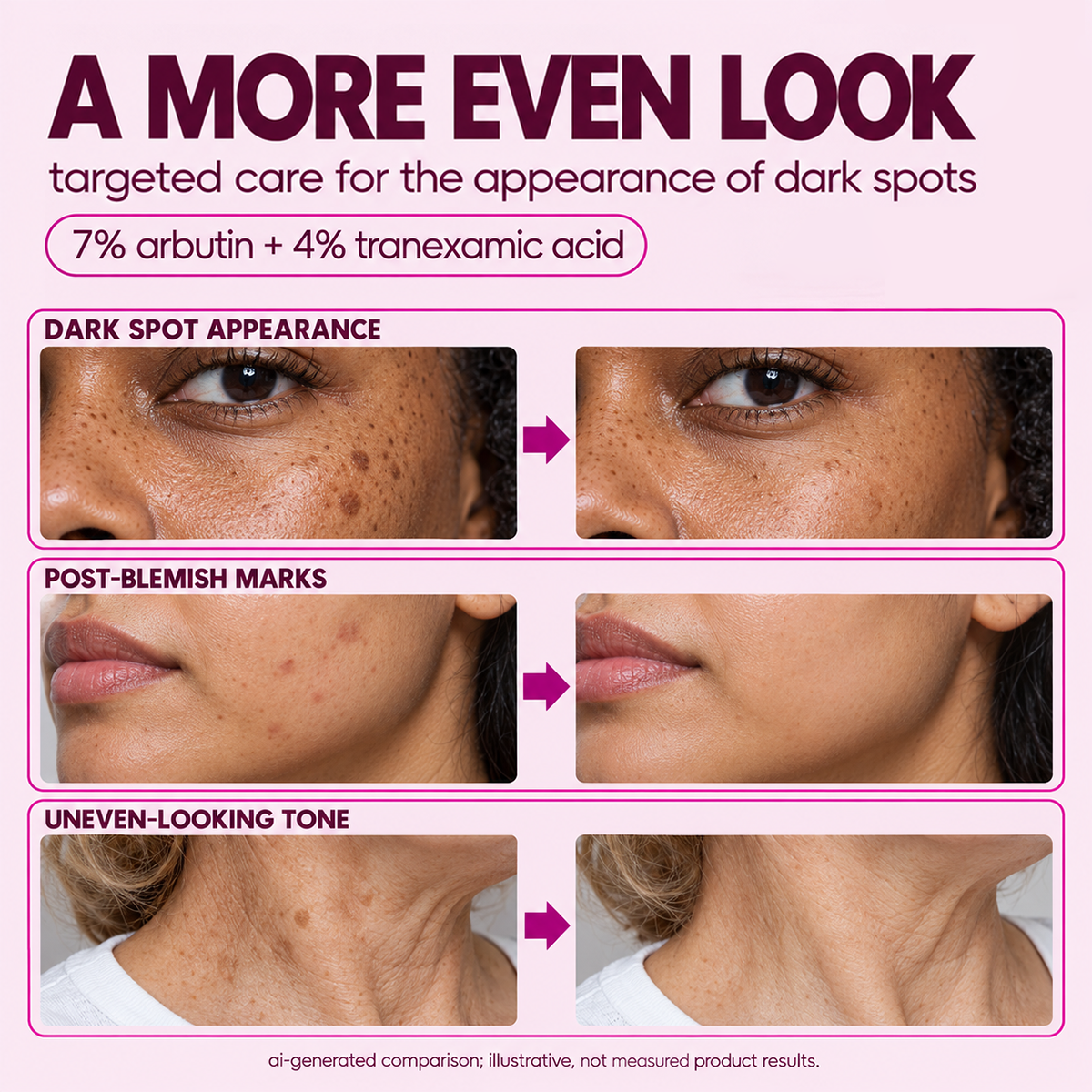Arbutin 7% + Tranexamic Acid 4% Cream