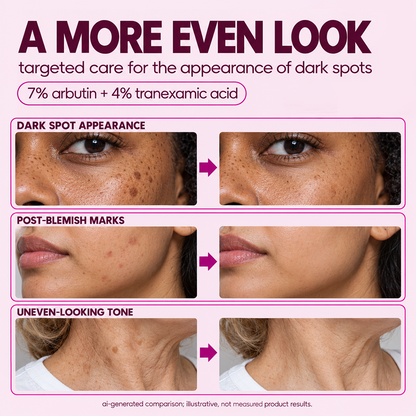 Arbutin 7% + Tranexamic Acid 4% Cream