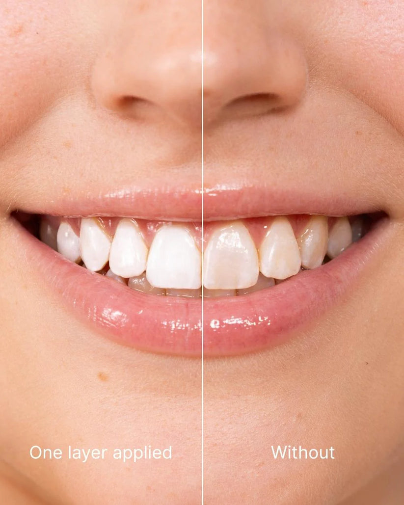 Tooth Polish - Instant White Smile
