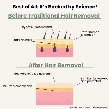 Rosenoot  Hair Removal Cream