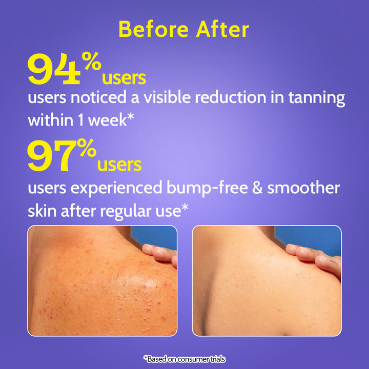 🍋 Exfoliating Body Wash with Lactic Acid