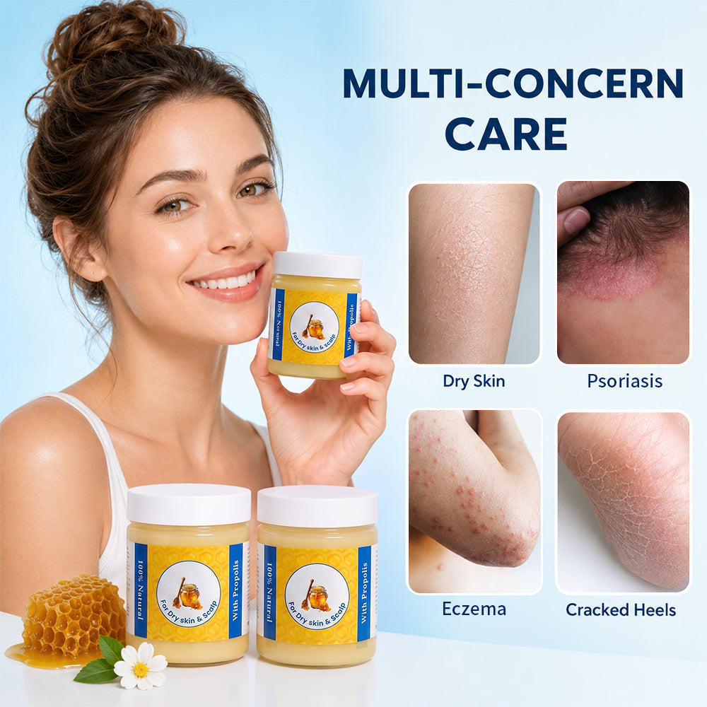 Repair Balm For Eczema & Psoriasis