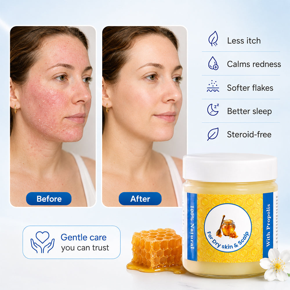 Repair Balm For Eczema & Psoriasis