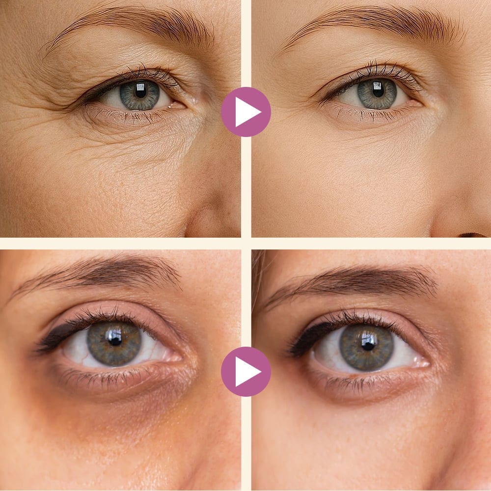 Calcium Dark Spot Eye Cream