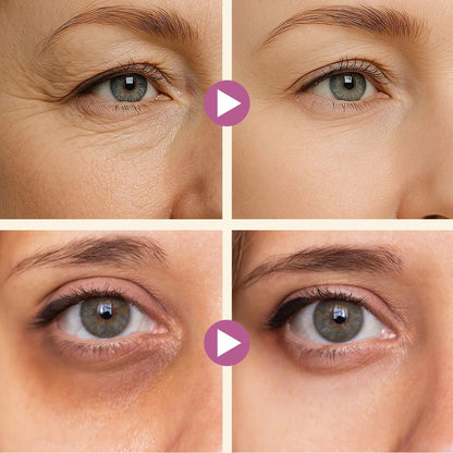 Calcium Dark Spot Eye Cream