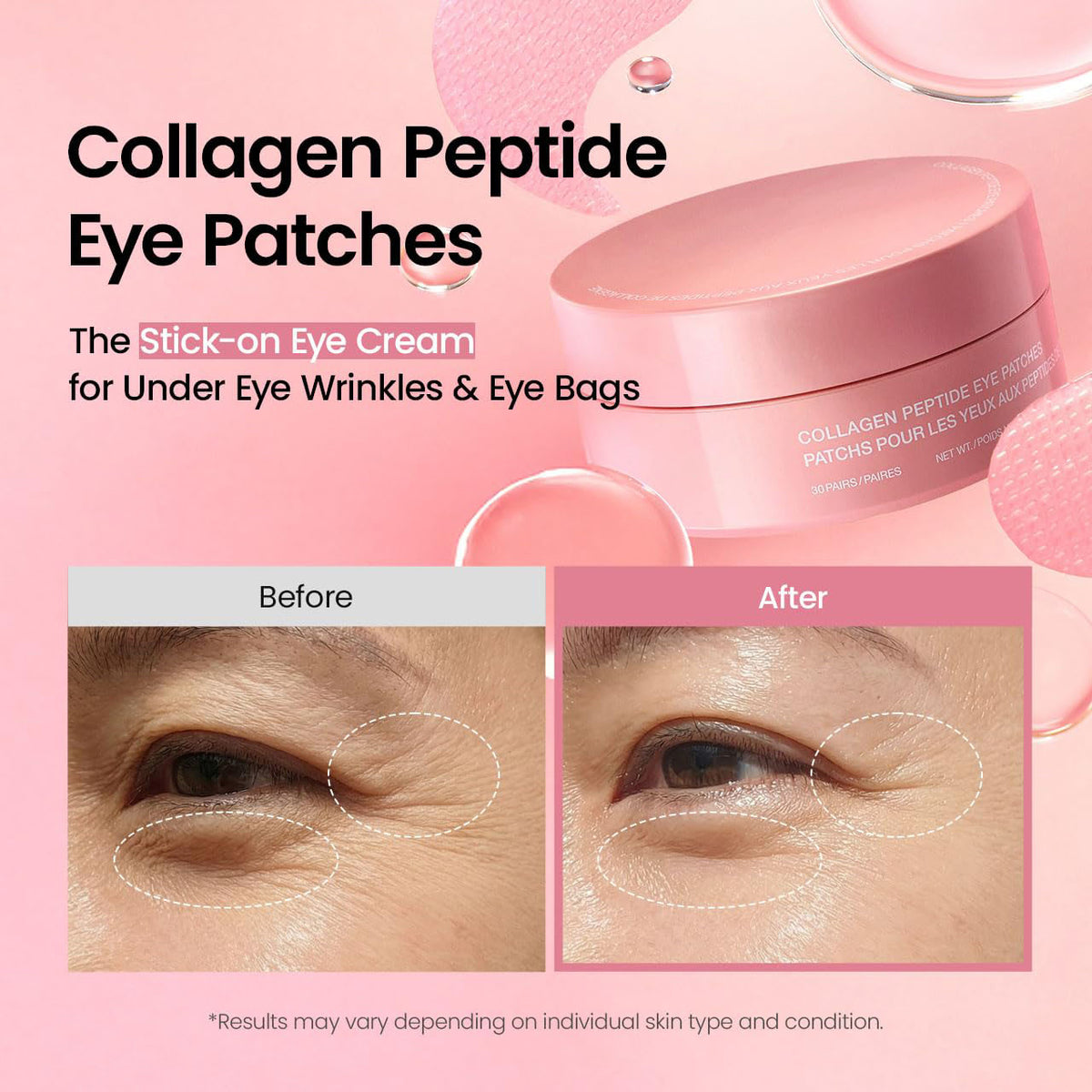 Collagen Eye Patches - Triple-Action Eye Complex