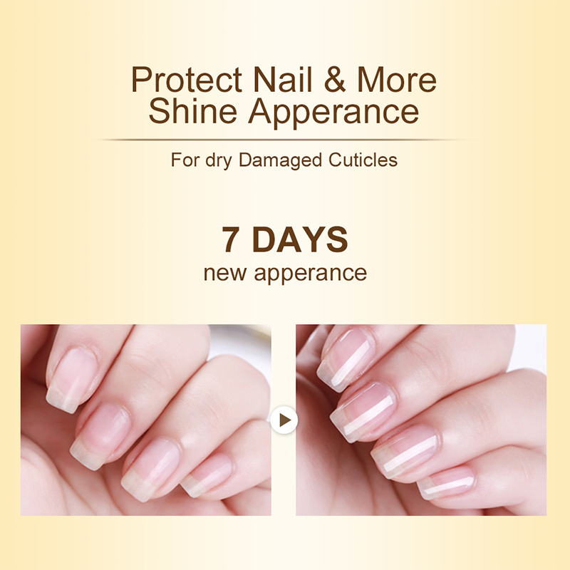 Cuticle Oil – Nourishing & Manicure-Perfect Finish